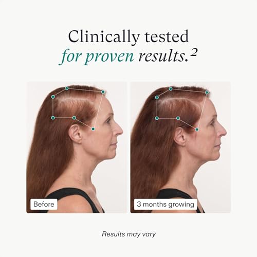 Nutrafol Women's Balance Hair Growth Supplements, Ages 45 and Up, Clinically Proven for Visibly Thicker Hair and Scalp Coverage, Dermatologist Recommended - 1 Month Supply-UPStoxs