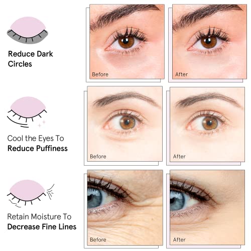 grace & stella Under Eye Mask (Gold, 24 Pairs) Reduce Dark Circles, Puffy Eyes, Undereye Bags, Wrinkles - Gel Under Eye Patches - Gifts for Women - Birthday Gifts for Women - Vegan Cruelty Free-UPStoxs